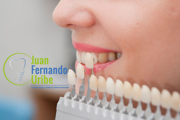 ¿Y DE QUE COLOR SON TUS DIENTES?