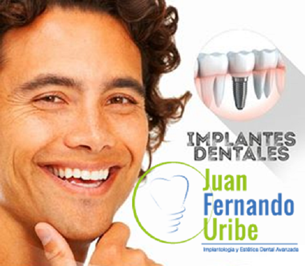 (Español) ¿haz pensado en el verdadero costo de los implantes dentales?